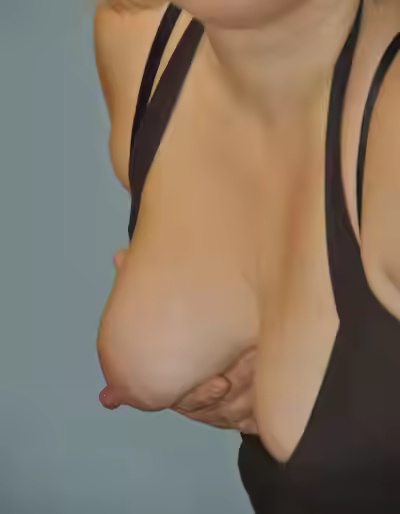 Saggy Tits